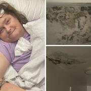 Bed-bound stroke survivor Kerry Lee says black mould is spreading through her Peabody flat in Bethnal Green